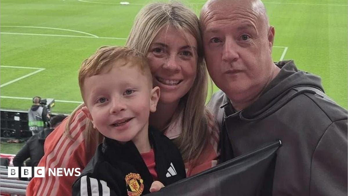 Man Utd maskoti Ruari va uning oyoqlari bilan bog'liq muammo