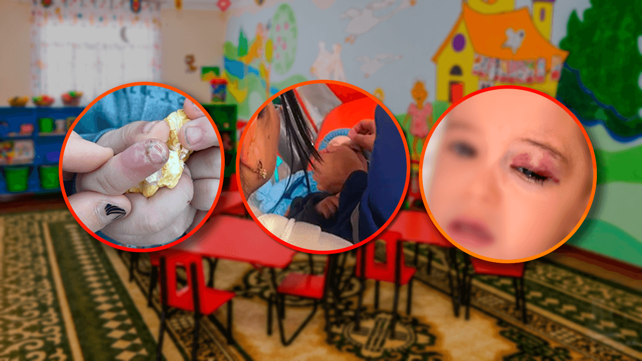 Olmazor tumanidagi davlat bog‘chasida egizak farzandlar zo‘ravonlikka uchradi